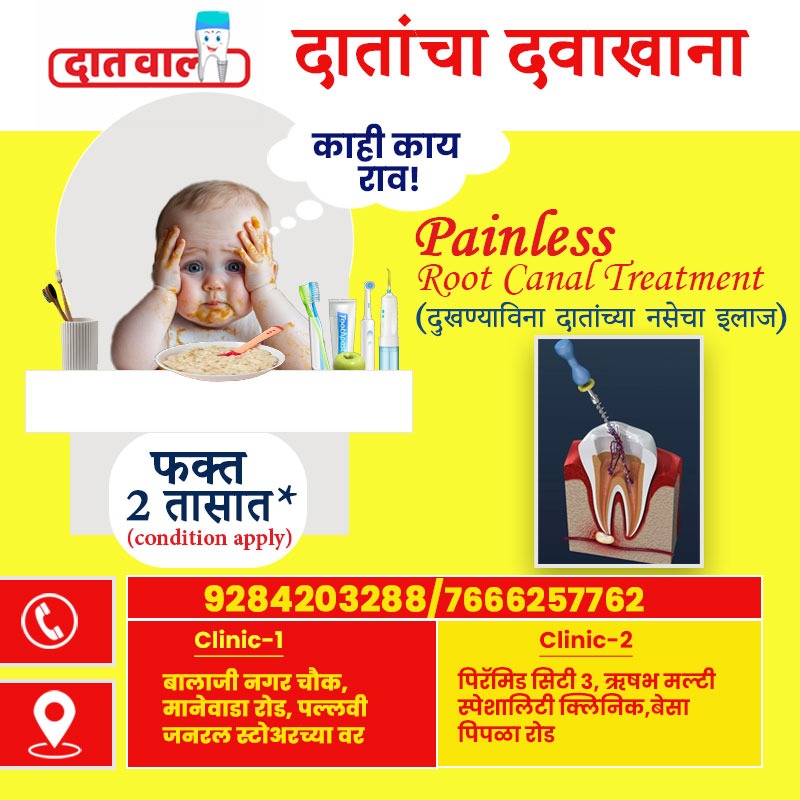 Dental Implants